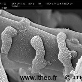 sites/agriculture-de-conservation.com/IMG/jpg/ithec-gliocladium.jpg